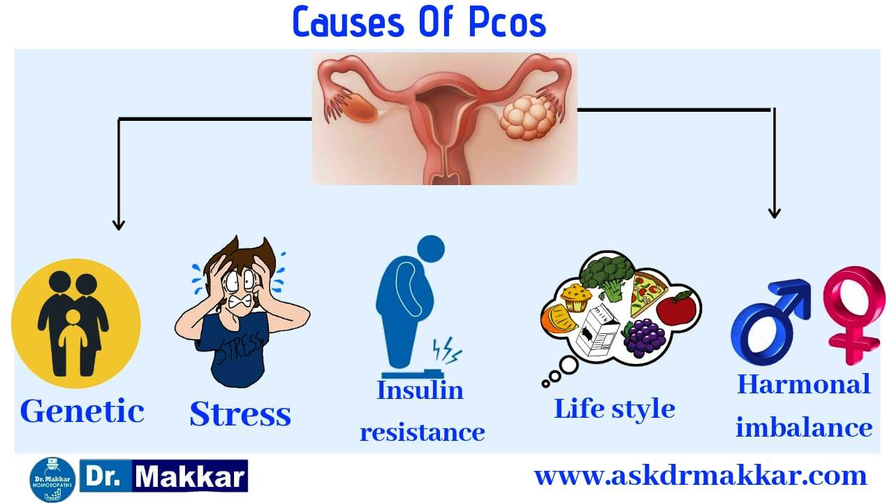 Poly Cystic Ovarian Syndrome PCOS Homeopathic Treatment PCOD Complex Female Disease Heft Of